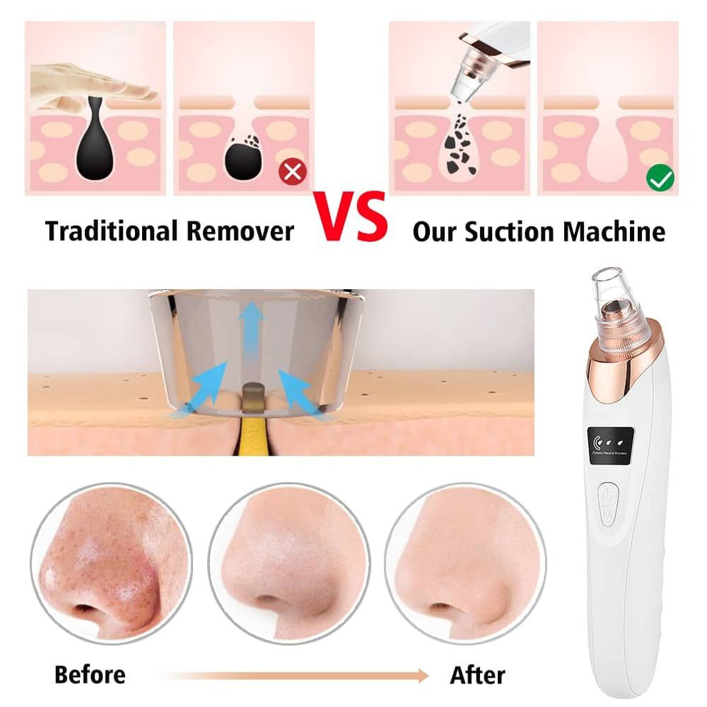 5 in 1 Rechargeable Blackhead Remover